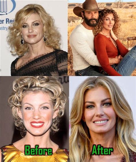 has faith hill had plastic surgery|Faith Hill’s Plastic Surgery in 2021: Does the People Magazine。